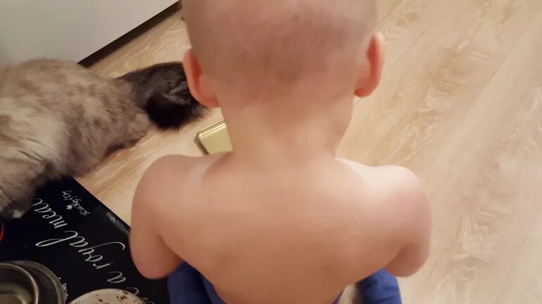 Подросток держится за голову. У ребенка болит шея больно поворачивать. Болит затылок, шея не поворачивается. Дискомфорт в шее с левой стороны. Болит.