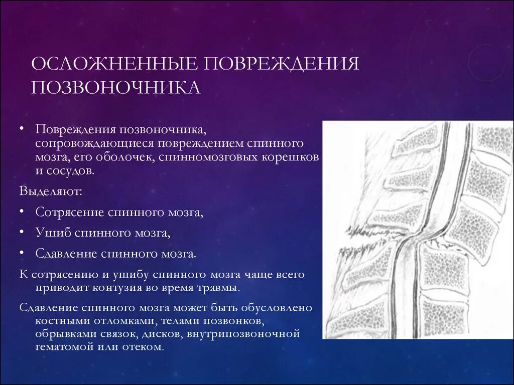 Сотрясение спинного. При повреждениях спинного мозга. Осложнения. Осложненные повреждения позвоночника. Осложнения повреждения позвоночника. Осложненные переломы позвоночника.