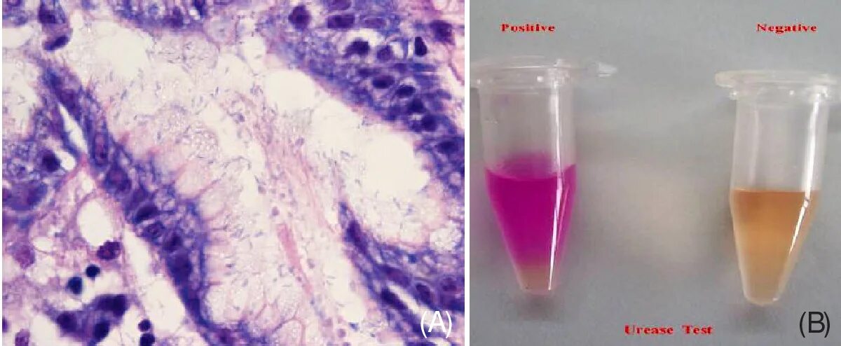 Исследование Helicobacter pylori биоптат. Хеликобактер микроскопия. Хеликобактер цитологический метод. Цитологический метод хеликобактер пилори. Биоптат слизистой оболочки