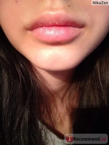 верхняя губа меньше нижней