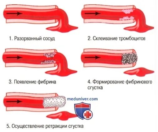 Повреждение кровеносных сосудов. Кровеносные сосуды повреждены. Повреждение мелких сосудов.