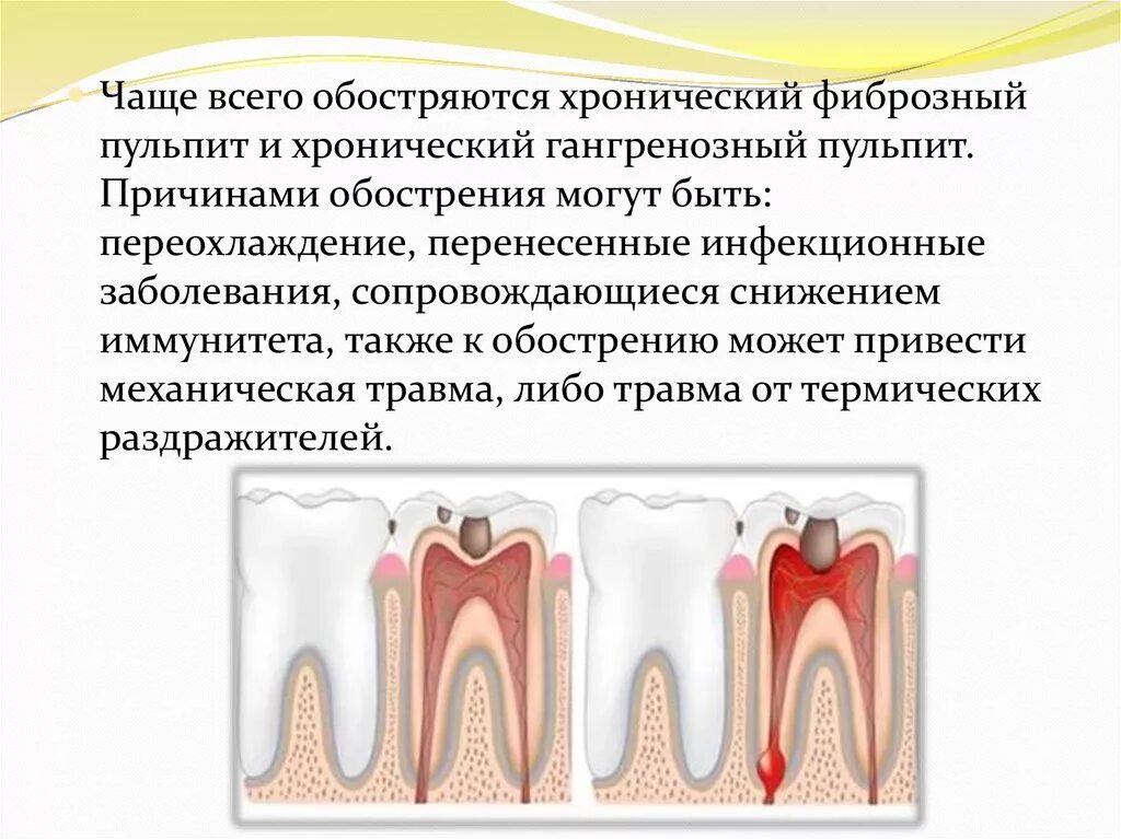 Осложнения лечения пульпита. Гипертрофический пульпит. Хронический периодонтит пульпит. Хронический гангренозный пульпит. Хронический периодонтит и хронический пульпит.