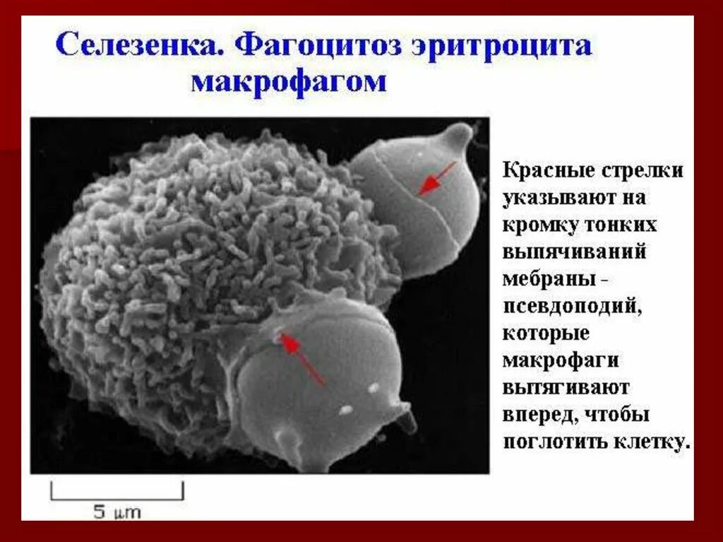 Железо в макрофагах. Фагоцитоз гистология. Селезеночные макрофаги. Фагоцитоз эритроцитов.