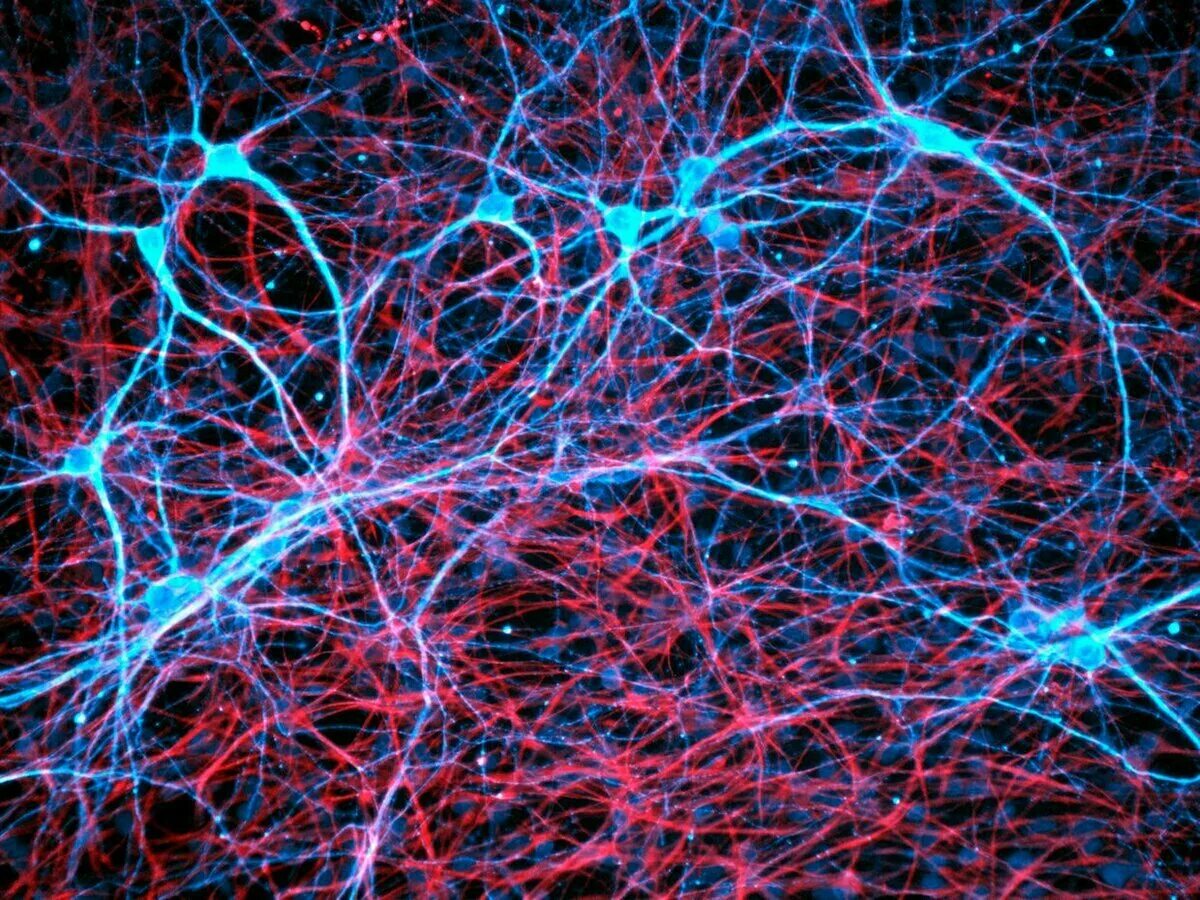 Нейросеть для превью. Нейронная сеть мозга Нейрон. Нейронные микросети. Нейрон клетка головного мозга. Нейронные клетки головного мозга.