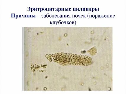 Почечный цилиндр
