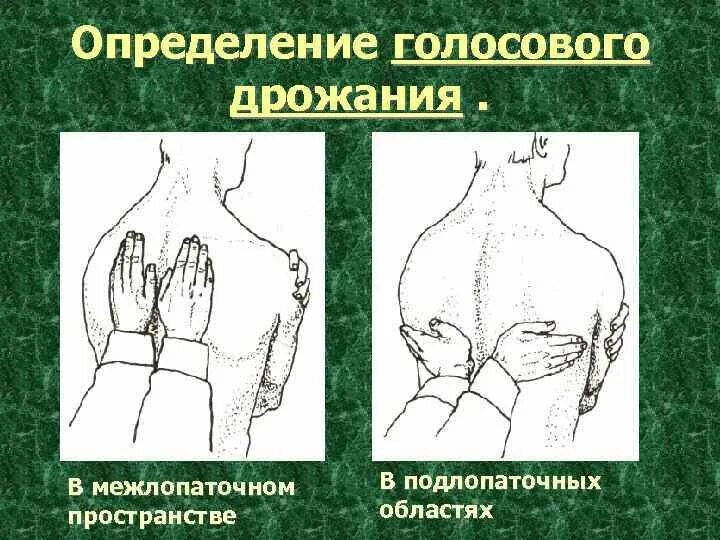 Определение голосового дрожжани. Ослабление голосового дрожания. Межлопаточное пространство. Голосовое дрожание точки.