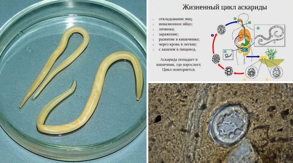 Паразиты черви аскариды. Нематоды Эустронгилидесы (eusrongylides). Строение нематоды круглых червей. Круглые черви аскарида человеческая.