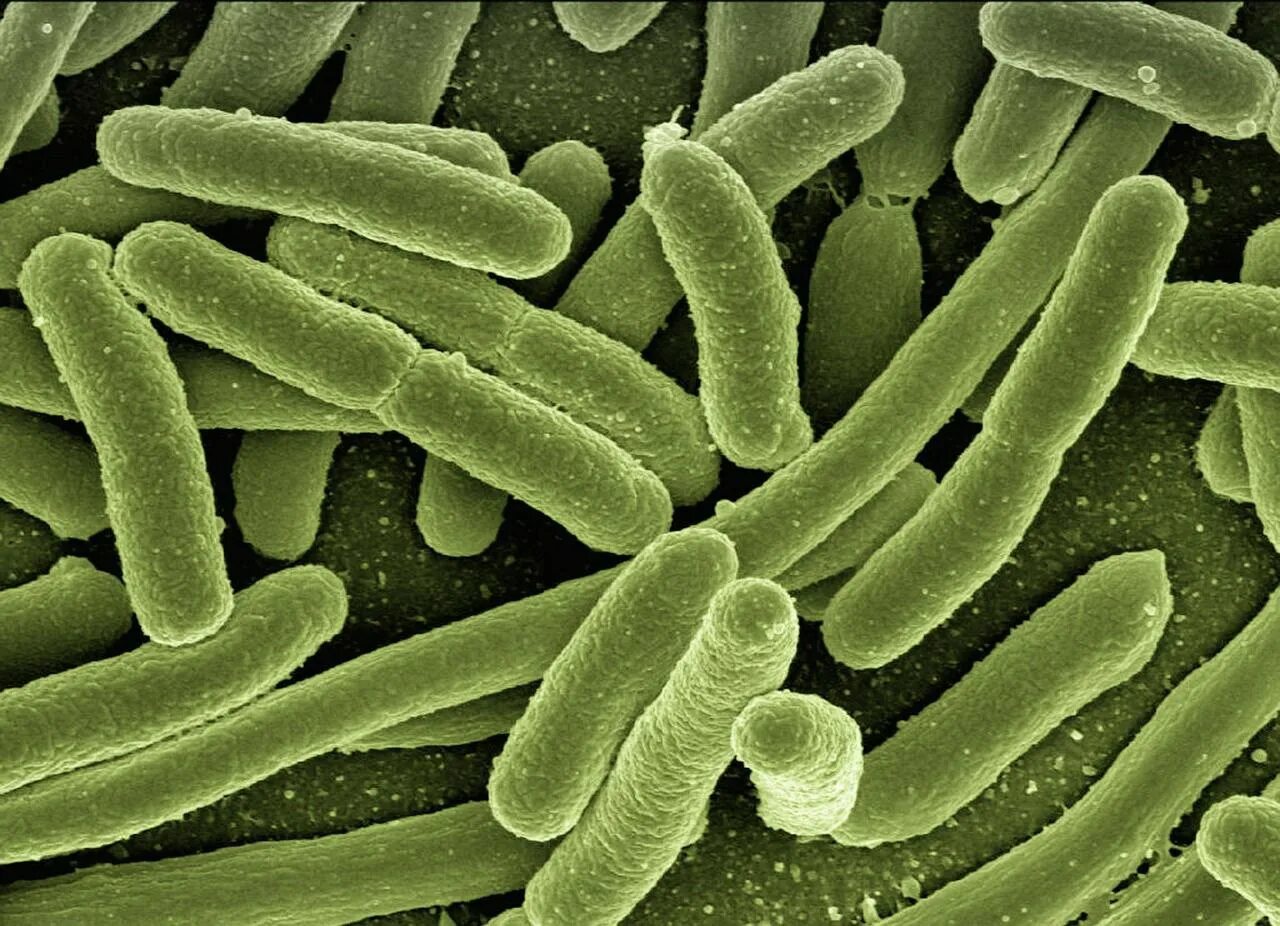 Микроорганизмы кишечная палочка. Бактерия Escherichia coli. Кишечная палочка микрофотография. Эшерихии палочковидные. Бактерии Azotobacter.