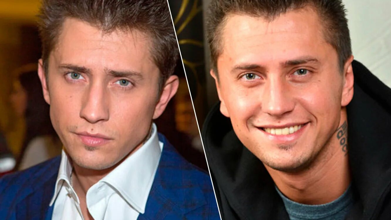 прилучный до и после пластики. павел прилучный пластика ушей. прилучный до и после пластики. павел прилучный до пластики. прилучный до и после пластики.