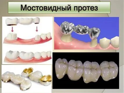 Пластмассовые коронки клинико лабораторные