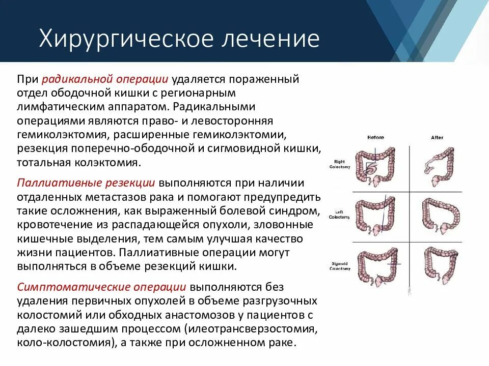 Хирургическое лечение для презентации. Комбинированные операции. Расширенная и комбинированная операция. Виды хирургического лечения