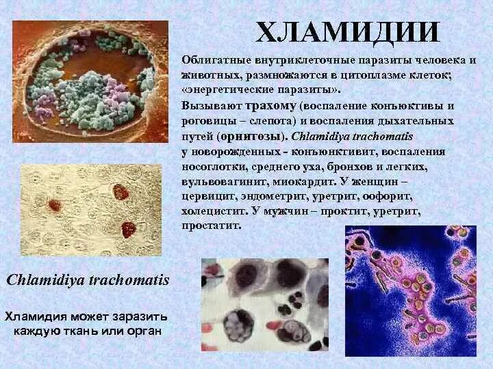 Хламидии как заражаются. Хламидии облигатные паразиты. Хламидии урогенитального хламидиоза. Хламидии внутриклеточные паразиты. Хламидии возбудитель орнитоза\.