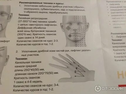 Техники введения мезотерапии