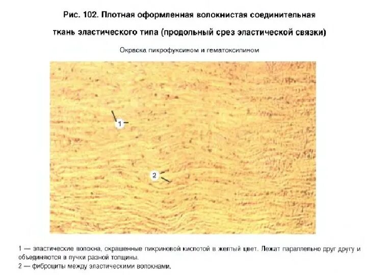 Эластическая связка. Плотная оформленная соединительная ткань препарат продольный срез. плотная эластическая соединительная ткань. волокнистая соелинитльная ткать продольный сре. плотная соединительная ткань связки препарат гистология.