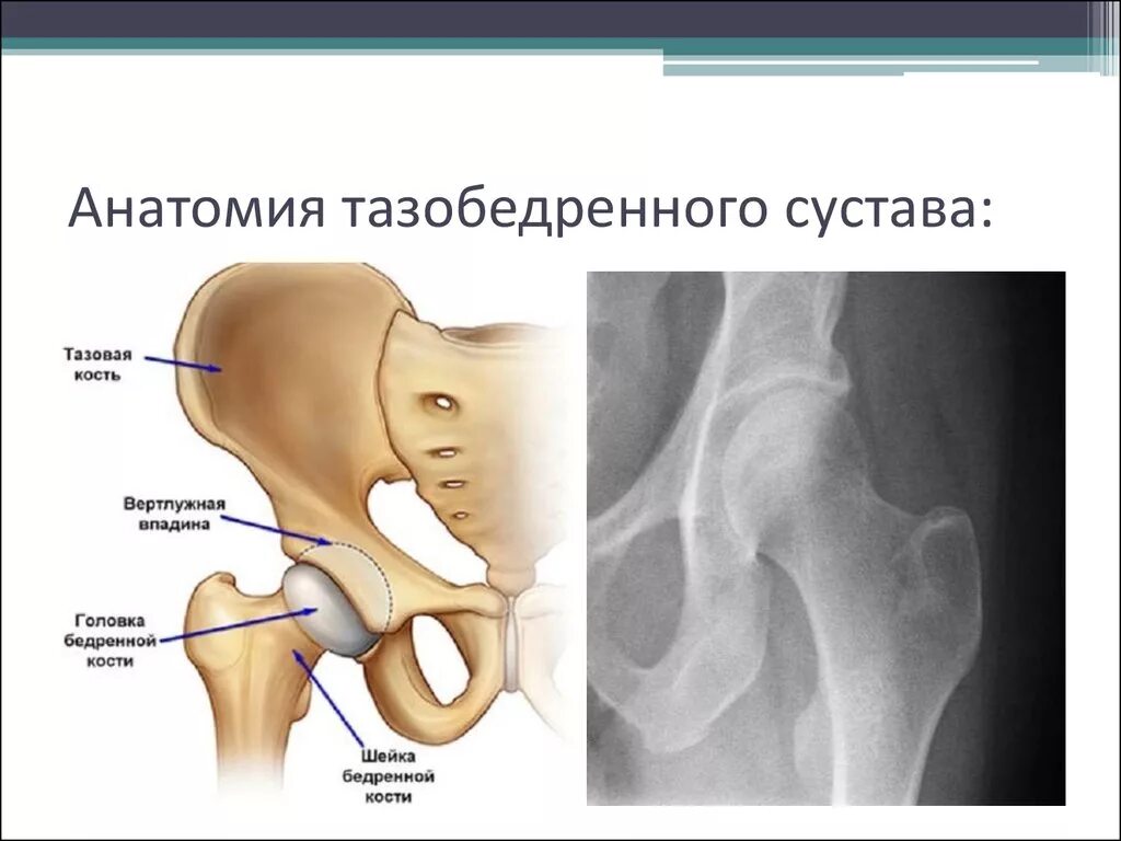 Тазобедренный сустав соединение. Вертлужная впадина анатомия человека. Анатомия тазобедренного сустава кости. Строение кости тазобедренного сустава. Тазобедренный сустав анатомия строение.