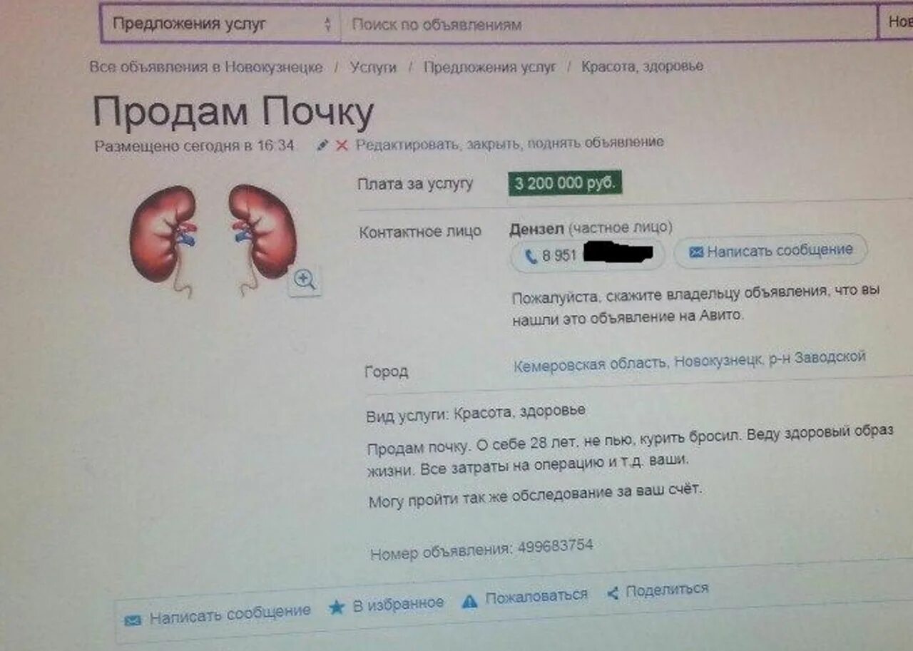 Сколько дают за продажу. Продать почку. Сколько стоит почка. Сколько стоит продать почку. За сколько можно продать почку.