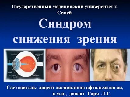 Синдром зрительных нарушений