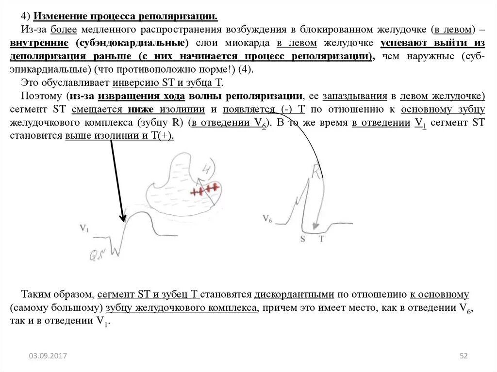 Умеренные изменения процесса реполяризации