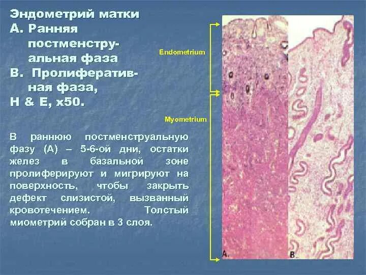 Постменструальная фаза гистология. Эндометрий фаза пролиферативная. Эндометрий в раннюю пролиферативную фазу. Женская половая система гистология. Железо и эндометрий