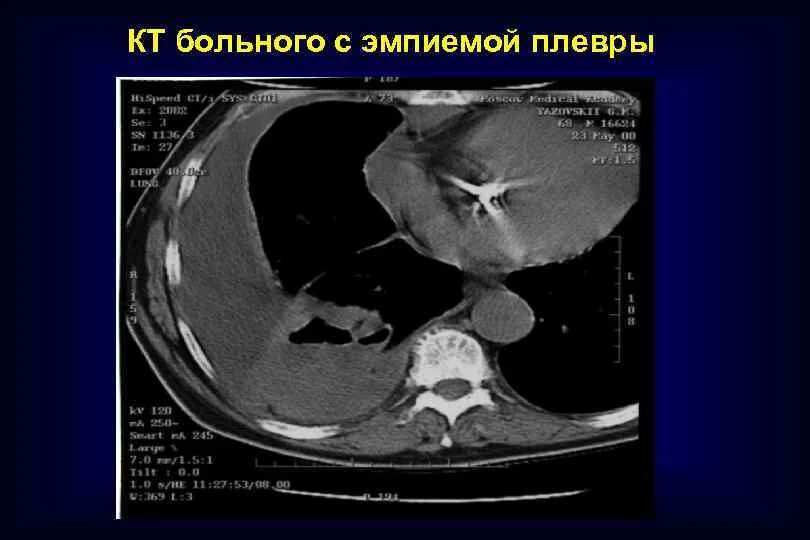 Болит кт. Болит кт