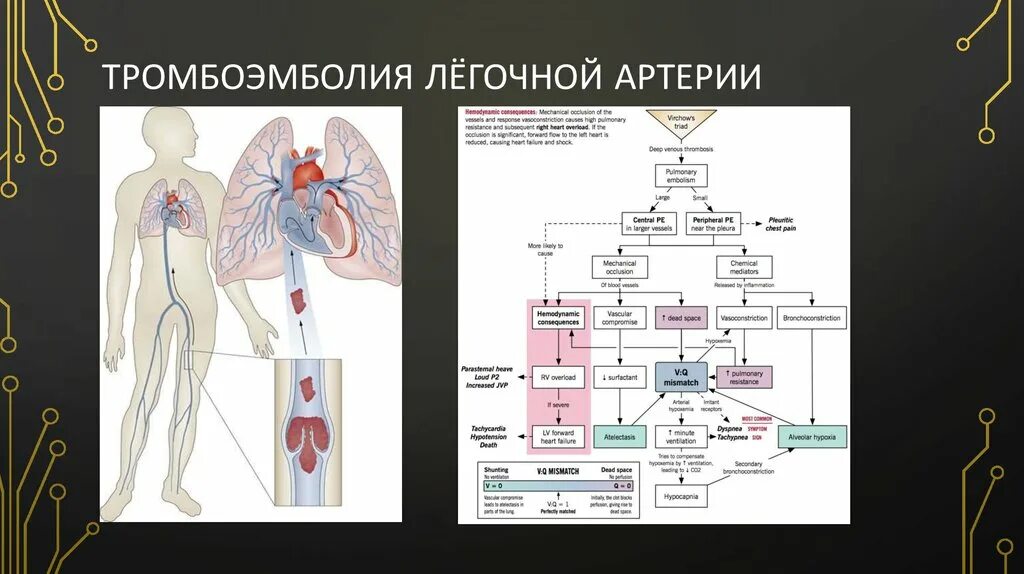 Тромбоэмболия легочной артерии прогноз. Тромбоэмболия легочной артерии. Тромбоэмболия ветвей легочной артерии клинические рекомендации. Тромбоэмболия легочной артерии причина смерти.