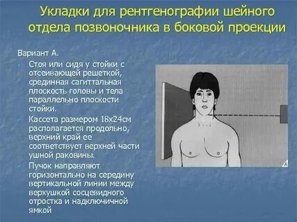 Рентген укладки