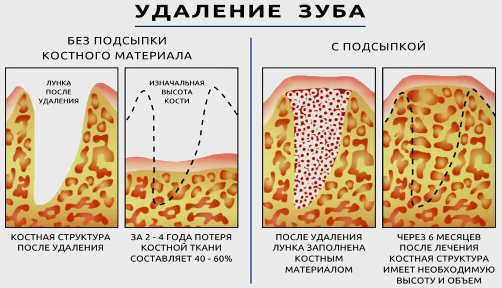 Про нашу регенерацию / Хабр