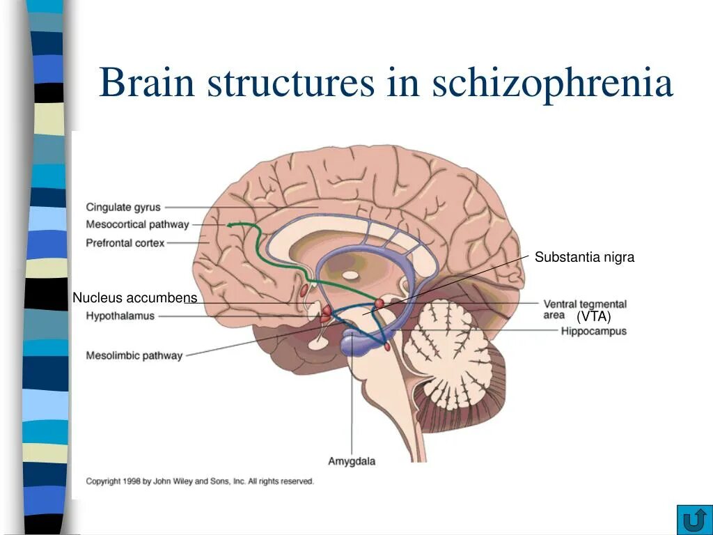 Schizophrenia Brain structures. Substantia nigra и эпифиз. Ядро accumbens. Mesocortical Pathway.