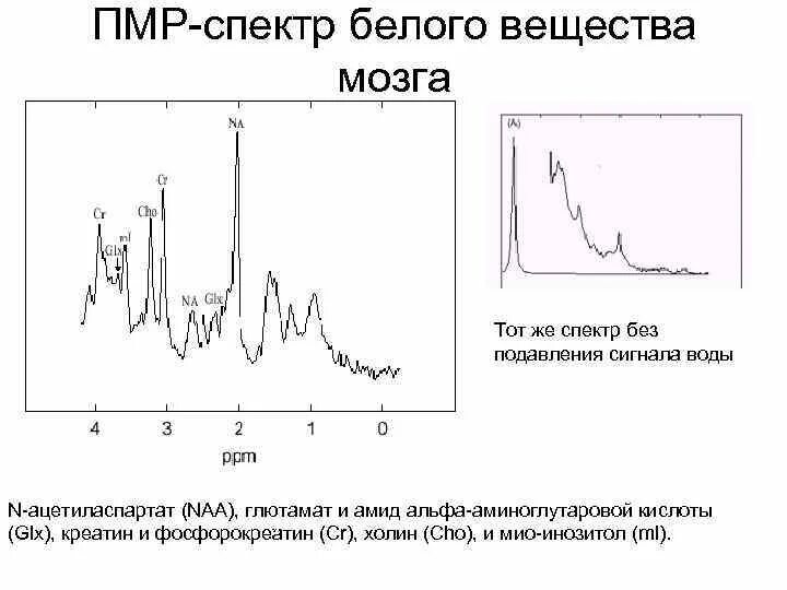 Пмр спектр. Расшифровка пмр спектров. пмр спектр триэтиламина. пмр спектр таблица. ямр спектр воды.