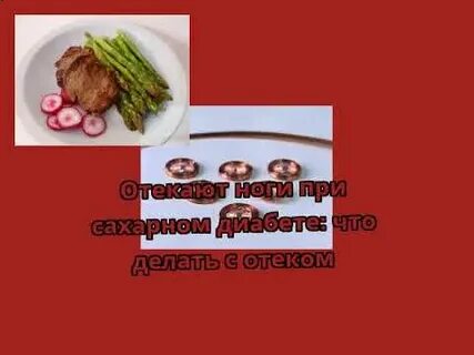 Отеки при сахарном диабете что делать