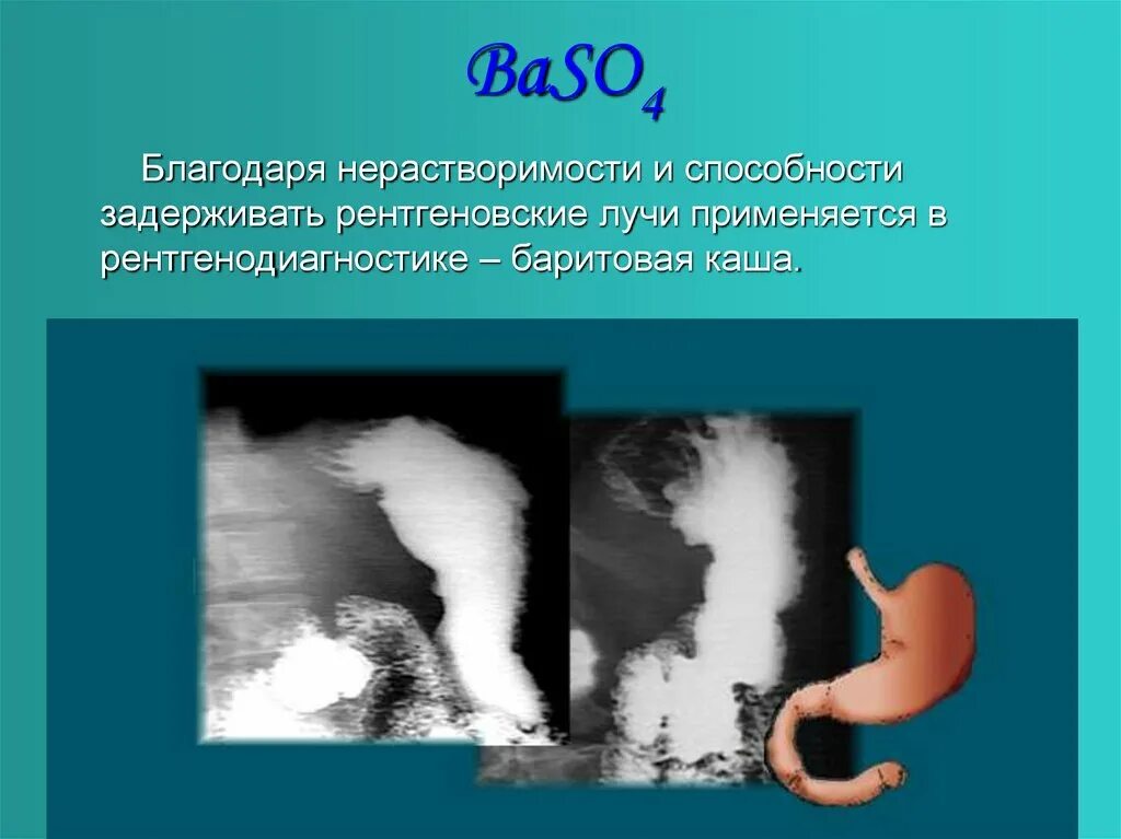 Бария сульфат препараты для рентгеноскопии. Бария сульфат для рентгеноскопии. Барий это смесь. Барий это смесь. Бария сульфат для рентгеноскопии.