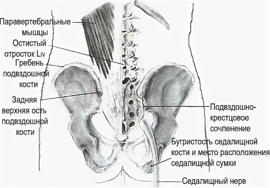 Задняя верхняя подвздошная ость. Задняя верхняя ость подвздошной кости. Верхний гребень подвздошной кости. Задневерэняя ость подзадлшноц.