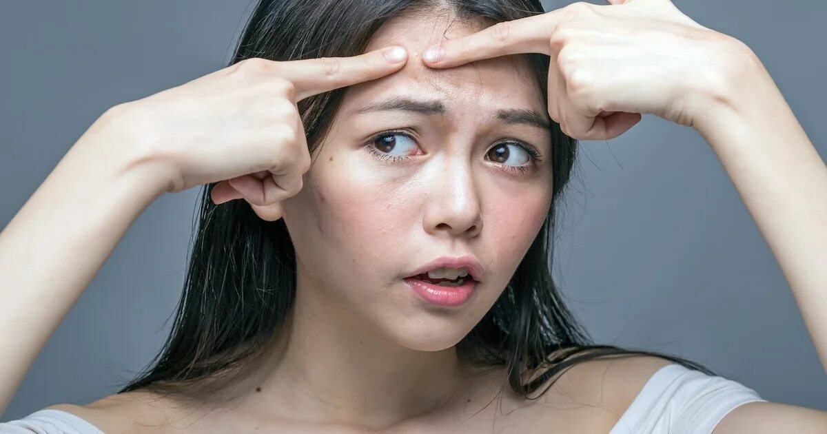 Face this problem. Лицо девушки с проблемной кожей. Лицо девушки наполовину. Девушка с проблемной кожей. Проблема клипарт.