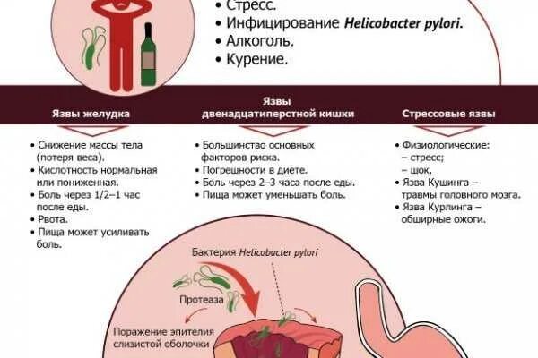 Можно сало при язве. Хеликобактер пилори язвенная болезнь. Профилактика хеликобактер пилори памятка. Язвенная болезнь желудка Helicobacter. Язвенная болезнь желудка хеликобактер.