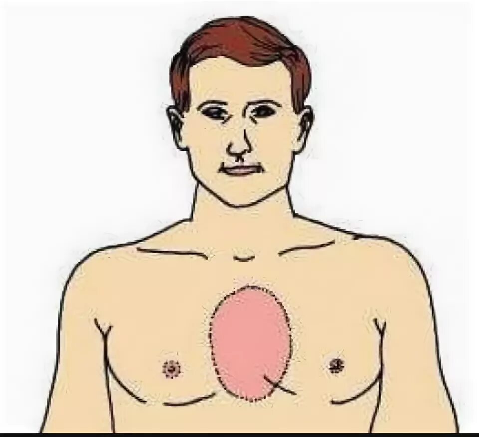 Болит посередине грудной клетки. Болит между грудями по середине. Сдавленность в грудной клетке. Нажать на сосок