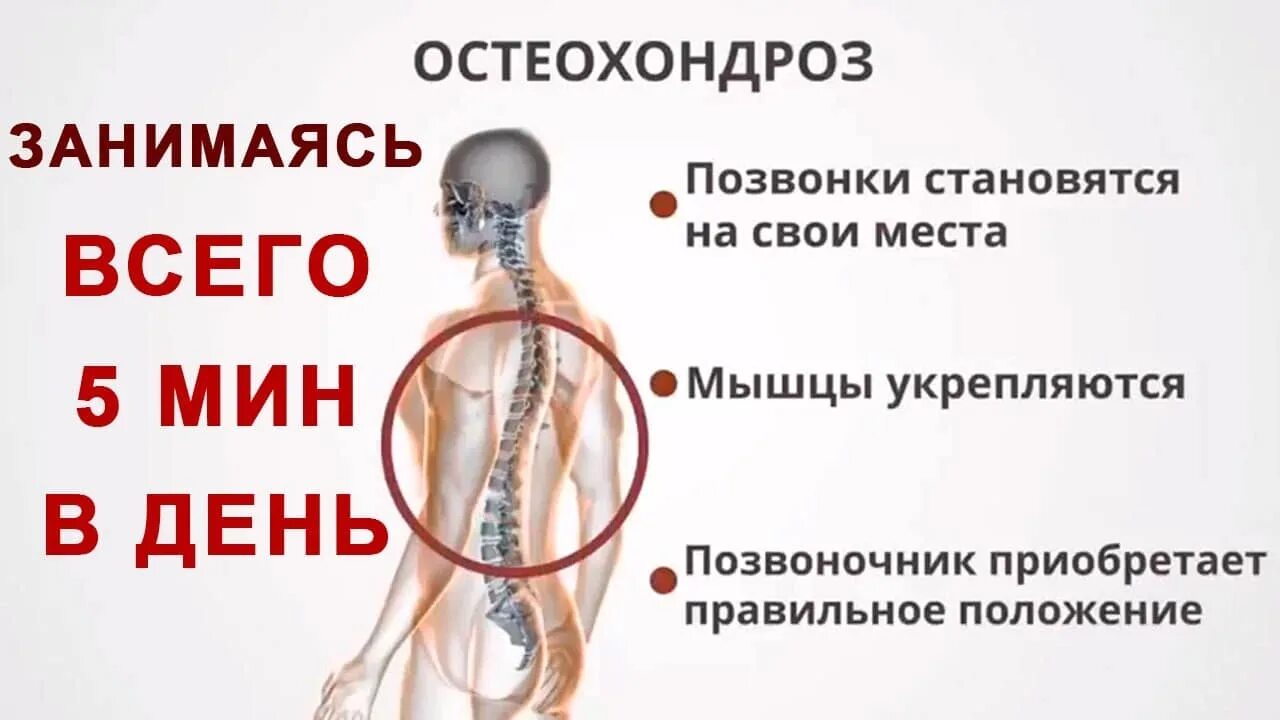 Давление при шейном остеохондрозе симптомы. Остеохондроз. профилактика при остеохондрозе. шейный остеохондроз симптомы. профилактика шейного остеохондроза.