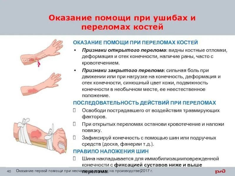 Что делать если сильно ударился. Алгоритм оказания первой помощи переломы конечностей. Меры оказания помощи при ушибах и переломах. Оказание первой помощи при переломах костей конечностей. Алгоритм оказания первой медицинской помощи при переломах ушибах.