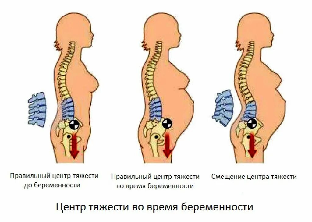 позвоночник беременной женщины. беременность копчик. беременность копчик. болит копчик при беременности. болит копчик после родов.