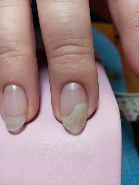 I'm a dermatologist and you could be suffering from a sinister condition - 9 sig
