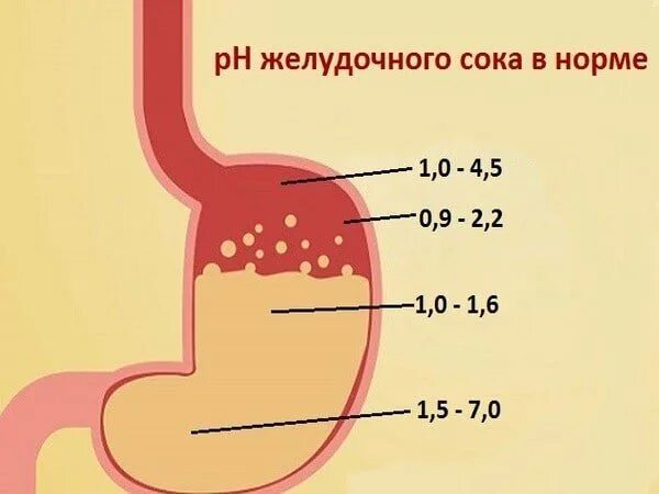 Гастрит повышенная кислотность. При повышении кислотности желудка. Желудок с повышенной кислотностью. Низкая кислотность желудка. Желудок с пониженной кислотностью.
