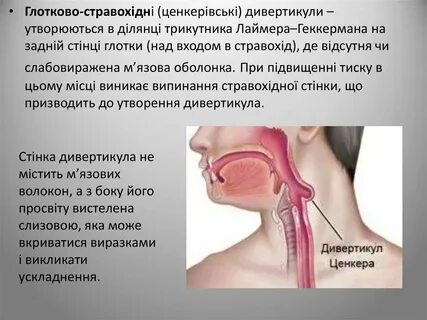 Яка може