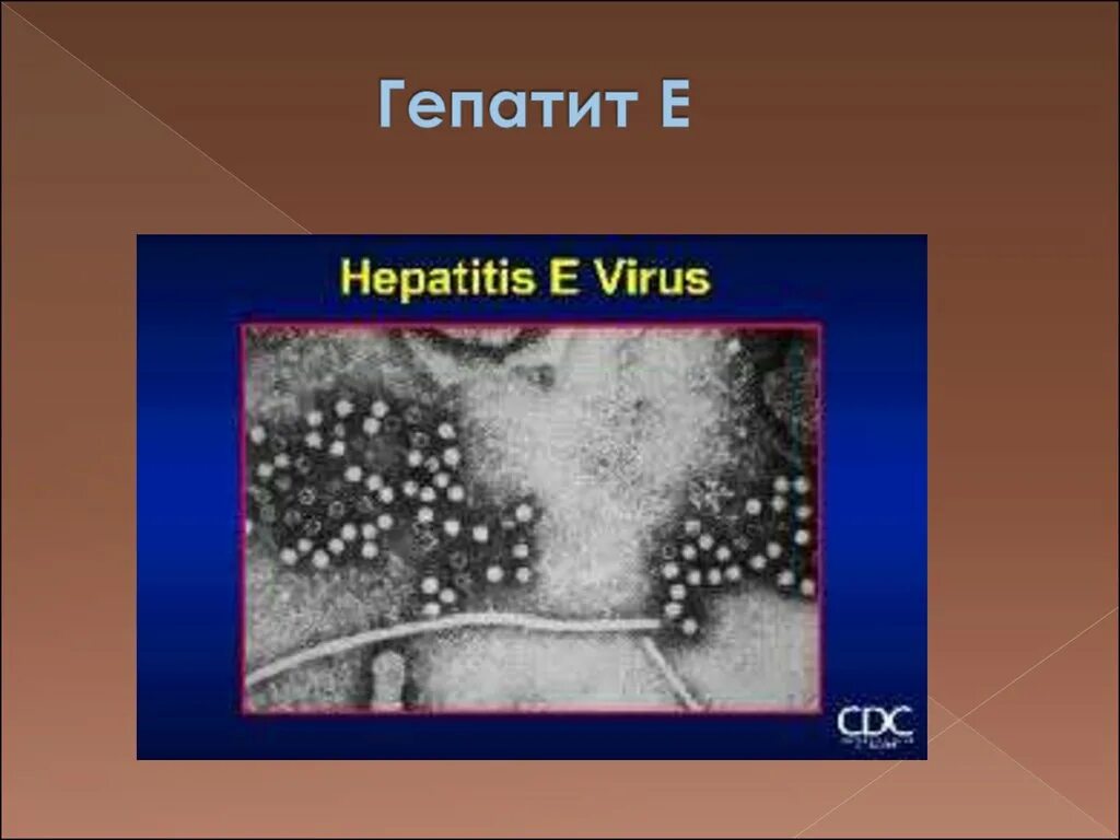 Гепатит а и е. Гепатит е презентация. Вирусный гепатит е возбудитель. Гепатит е структура. Вирус гепатита e.