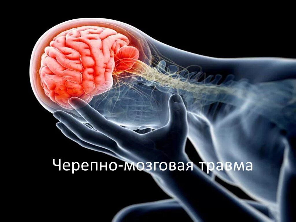 Травма в мозгу повреждения. Непроникающая черепно-мозговая травма это. ЧМТ ушиб головного мозга. Черепно-мозговая травма презентация. Черепно мозговые ранения.