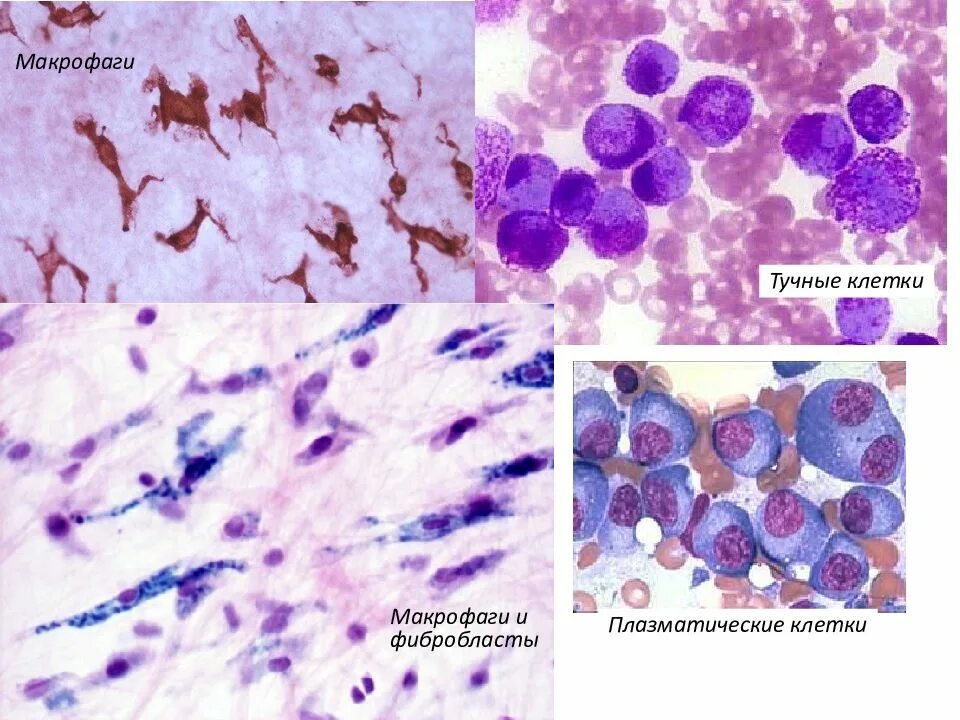 Макрофаги препарат. Фибробласты фиброциты фибробласты. Макрофаги гистология. Тучные клетки это макрофаги. Тучные клетки гистология препарат.