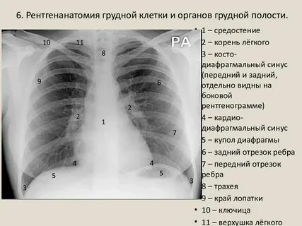 Ультразвуковое исследование органов грудной клетки