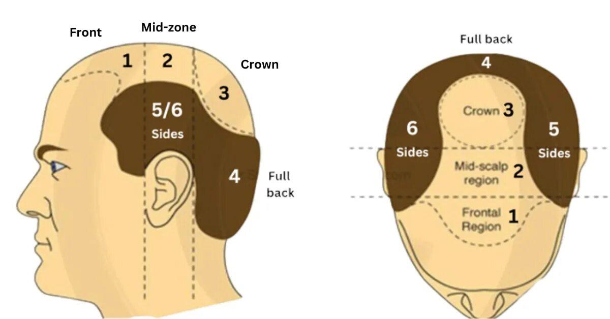 Scalp перевод. Область вертекса на голове. Вертекс головы.