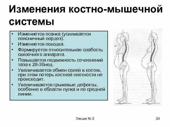 Как изменится система. Изменения в костно мышечной системе при беременности. Осанка беременных. Опорно двигательный аппарат у беременных. Изменение осанки при беременности.