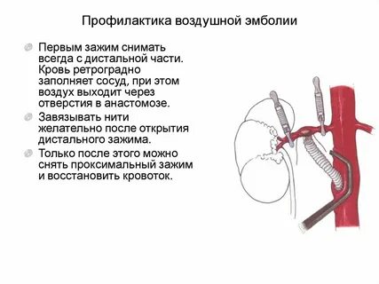 Профилактика масляной эмболии