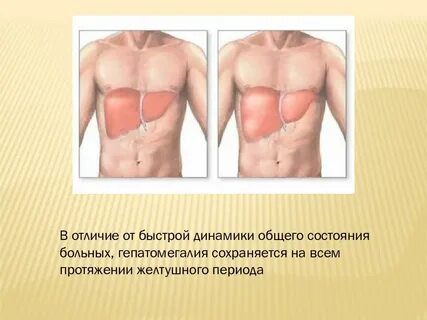 Увеличение печени причины симптомы у женщин