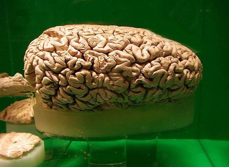 Large brain